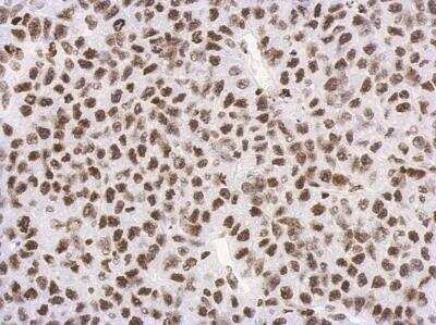 Immunohistochemistry-Paraffin: Histone H3 [Trimethyl Lys27] Antibody [NBP2-16840]
